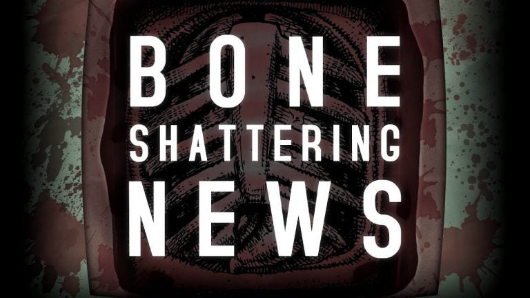 surgeon simulator cpr announced